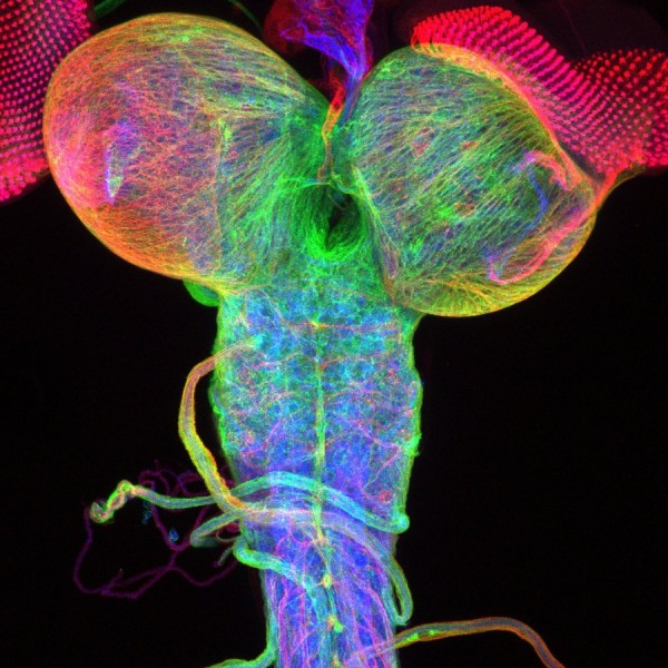 tian-klambt-and-imke-schmidt-got-this-image-of-a-fruit-fly-brain-by-marking-the-structural-proteins-of-the-cells-it-shows-the-developing-eye-disks-as-well